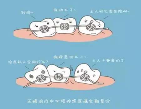 到医院洗牙多少钱一次？实际案例和费用构成了解